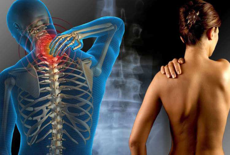 Ženska z bolečinami v mišicah ramen.